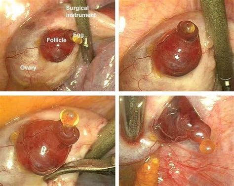 Human egg makes accidental debut on camera